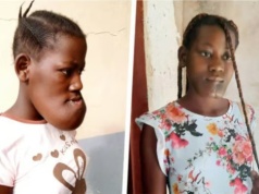 Olsztyńscy lekarze ponownie pomogą 17-letniej Cristinie z Angoli. Trwa zbiórka środków