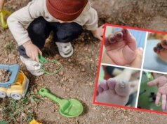 Palce 2-latka zaczęły sinieć po zabawie na zimnie. Rodzice byli przerażeni tym, co zobaczyli