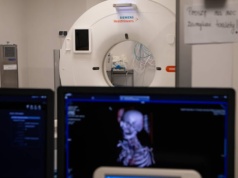 Awaria tomografu w szpitalu w Sieradzu. NFZ został poinformowany dopiero po pytaniach redakcji