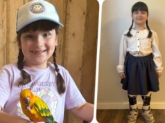 7-letnia Marcelinka z Kozłowa walczy o dzieciństwo bez bólu. Trwa zbiórka na pilną operację biodra