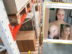 29-latka przeżyła koszmar podczas pracy w hali produkcyjnej. "Poczułam, że coś ciągnie mnie za włosy"