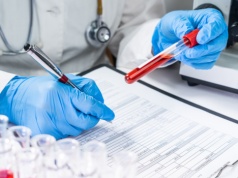 Nie ma bezpiecznego poziomu ołowiu. MZ przedstawia projekt nowych norm