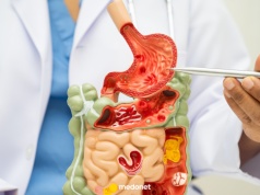 Bakterie jelitowe wpływają na serce. Odkrycie może zmienić leczenie choroby wieńcowej