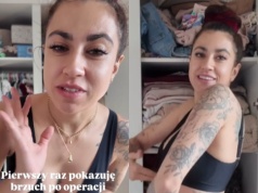 Maja Hyży odsłoniła brzuch miesiąc po operacji. "Wiem, że wszyscy patrzą na jedno"