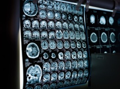 Zamrożone mózgi „ożyły”. Naukowcy z Niemiec dokonali przełomu