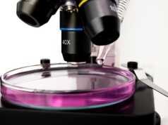 Gdy światło przestało wystarczać. Historia mikroskopu elektronowego