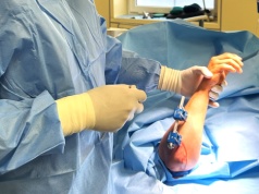 Nowoczesne zabiegi wydłużania kości u dzieci w Bielsku-Białej