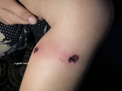 Izraelscy żołnierze torturowali rocznego chłopca, aby wymusić zeznania od ojca