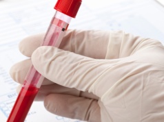 To dlatego nie możesz schudnąć. Najsilniejszy przeciwnik odchudzania