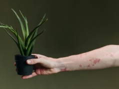 Łupież różowy – charakterystyczna wysypka o nieznanej przyczynie