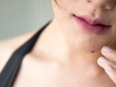 Ma je prawie każdy. To odróżnia "zwykłe" wypukłe znamiona od tych groźnych