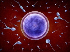 Teratozoospermia: przyczyny, objawy, diagnostyka i leczenie 