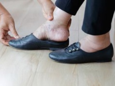 Pięta Haglunda to problem nie tylko estetyczny. Dotyka takich kobiet