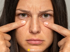 To serum rozjaśni najgorsze cienie pod oczami jak laser! Odmładza spojrzenie