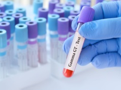 Przyczyny i skutki podwyższonego GGTP. Co to oznacza i jak je obniżyć?   