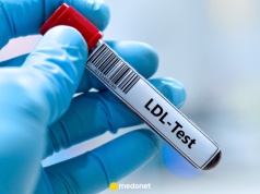 Mam podwyższony cholesterol, co dalej? Kardiolog: zawsze pytam o jedną rzecz