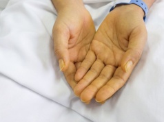 Żółta skóra – czego może być objawem? Sprawdź możliwe przyczyny