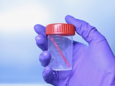 Śluz w kale: co może być przyczyną i kiedy stolec ze śluzem powinien niepokoić?