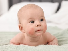 Alergia pokarmowa u niemowląt i dzieci – jakie są jej objawy? Przyczyny, diagnostyka i leczenie