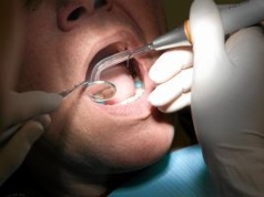 Hurtownia przysłała stomatolożce paczkę, a w niej ostrzeżenie: "Niedługo będziemy mieć z tym problem"