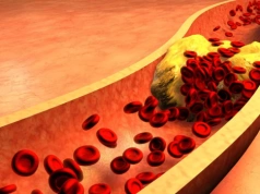 Kardiolog o mitach z wiązanych z miażdżycą, cholesterolem i statynami. „Słyszałem, że zmuszam do trucizny"