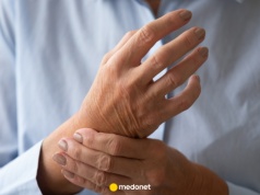 Takie objawy daje toczeń na wczesnym etapie. Zwróć uwagę na te znaki