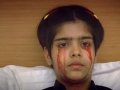 Dziewczynka płakała krwią. Rzadki przypadek medyczny