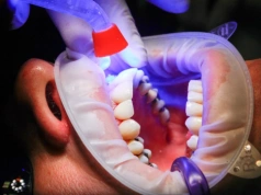 Chciał odliczyć równe zęby od podatku. Cios fiskusa w szczękę