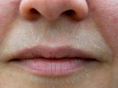 Zapomnij o depilacji. Tak usuniesz wąsik za grosze i bez wychodzenia z domu