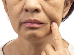 Ten krem to remedium na „chomiki” - modeluje owal twarzy, wypełnia zmarszczki i ujędrnia