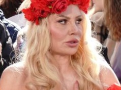 Monika Jarosińska przeżyła dramat po operacji kręgosłupa. "Nie chodziłam przez TRZY MIESIĄCE"