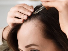 Remedium na łysienie! Ta wcierka do włosów działa cuda na zakola - daje wysyp baby hair