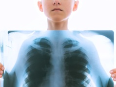 Ponad 180 dzieci przejdzie badania. Miały kontakt z nauczycielką chorą na gruźlicę