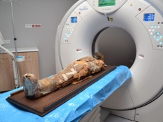 Egipska mumia pod lupą radiologów z Lublina. Niezwykła współpraca medycyny i nauki