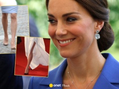 Rozporki, rozcięcia i miniówki. Rok, w którym księżna Kate odsłaniała nogi