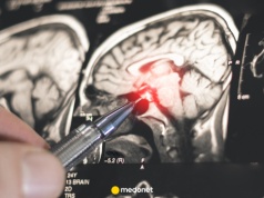 Liczba chorych stale rośnie. "To czas, gdy choroba rozwija się w ukryciu"