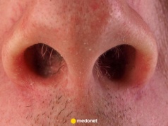 Tym nawykiem "pracujesz" na alzheimera. Robimy to, gdy nikt nie patrzy