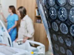 Przeszła udar. Lekarze chcieli pomóc. "Rezultaty były wstrząsające"