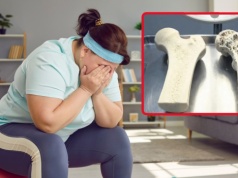 Ozempic rozpuszcza kości? Z małego badania powstał wielki mit