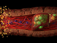Badania wskazują, że nadmierne spożycie fruktozy może powodować zwiększoną przepuszczalność jelitową, przyczyniając się do rozwoju stłuszczenia wątroby