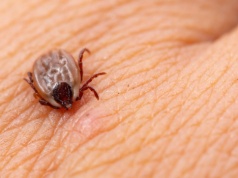 Są nie tylko w lasach, ale też w mieście. Tak uchronisz się przed kleszczem