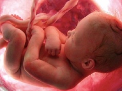 Większa prawna ochrona życia dzieci służy też ich matkom