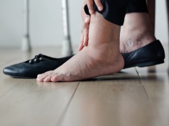 Obrzęk kostek – przyczyny, diagnostyka i leczenie