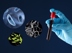 Badania krwi w kierunku chorób pasożytniczych – co wykrywają i kiedy należy je robić?