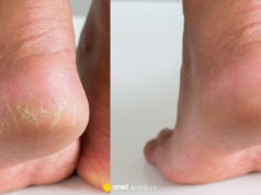 Szorstkie pięty? Ten naturalny peeling z olejkami robi z nimi porządek w kilka minut