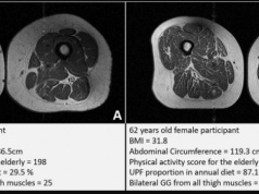 Jesz parówki, mrożoną pizzę i inną ultraprzetworzoną żywność? Osłabiasz swoje mięśnie