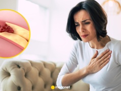 Wysoki cholesterol to sygnał ostrzegawczy. Lekarz mówi, kiedy nie wolno go ignorować