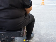 Otyłość to choroba przewlekła, a nie brak silnej woli. Te mity wciąż utrudniają leczenie