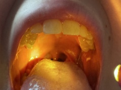 Nowe światło na źrenice dzieci, czyli recenzja latarki Mactronic MedLite