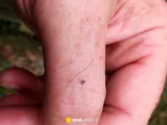 Ludzie często mylą je z pieprzykami. Są groźne tak samo, jak kleszcze